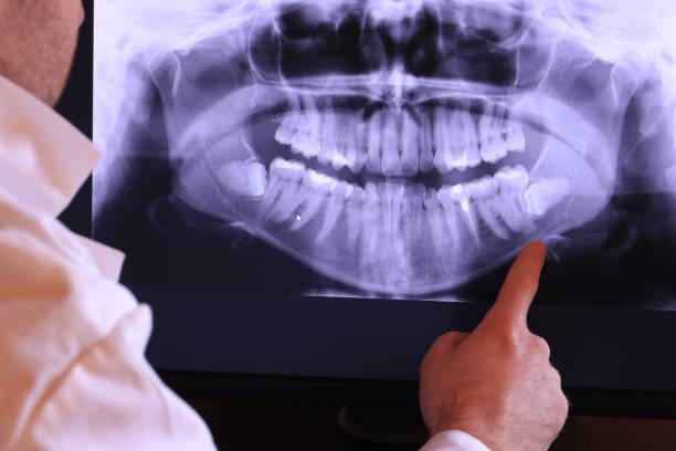 Best Emergency TMJ Treatment in Ives Estates, FL